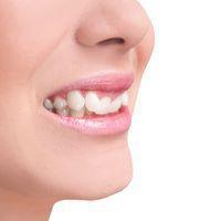 Crooked Teeth
