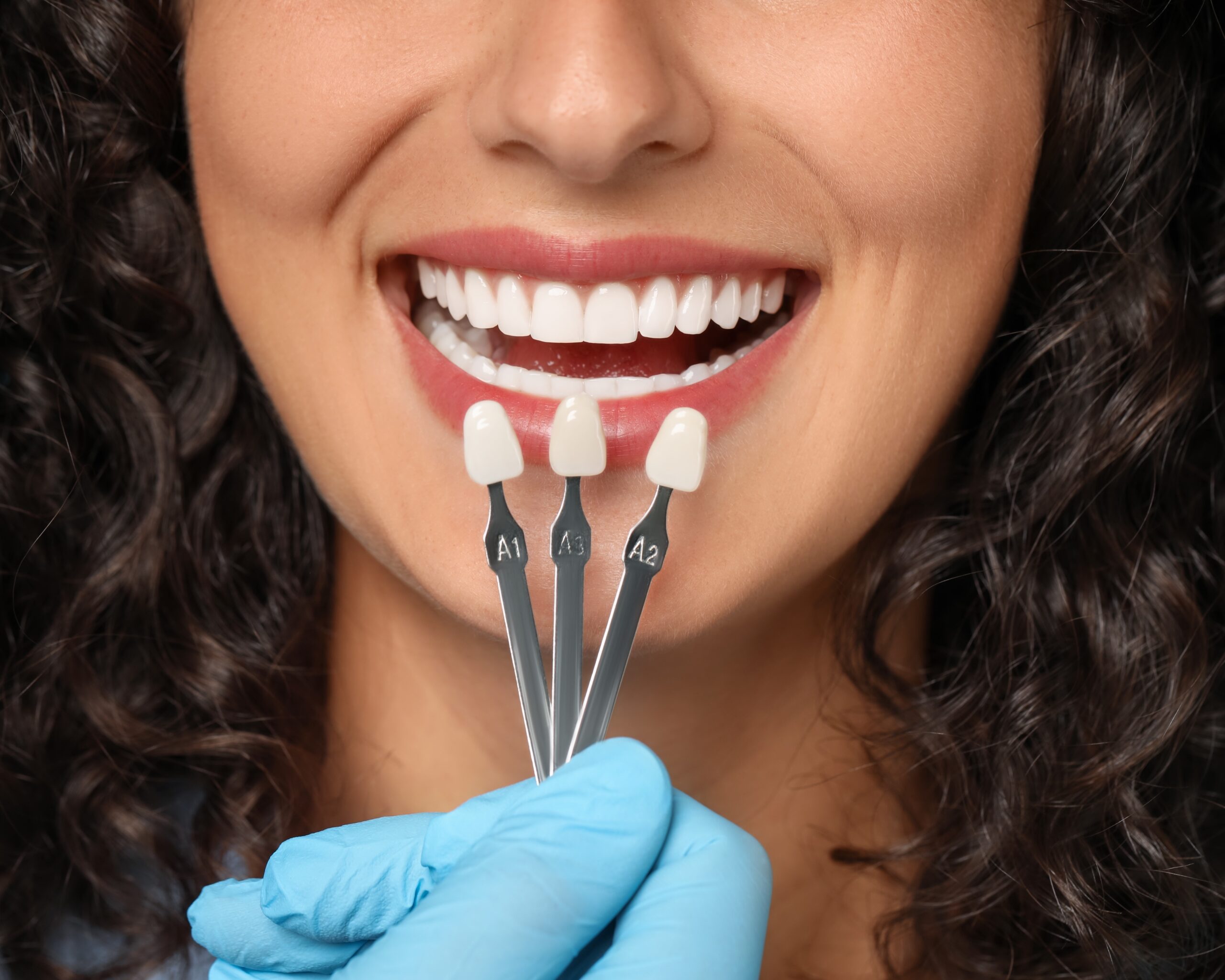Woman Smiling with Veneer Color Options