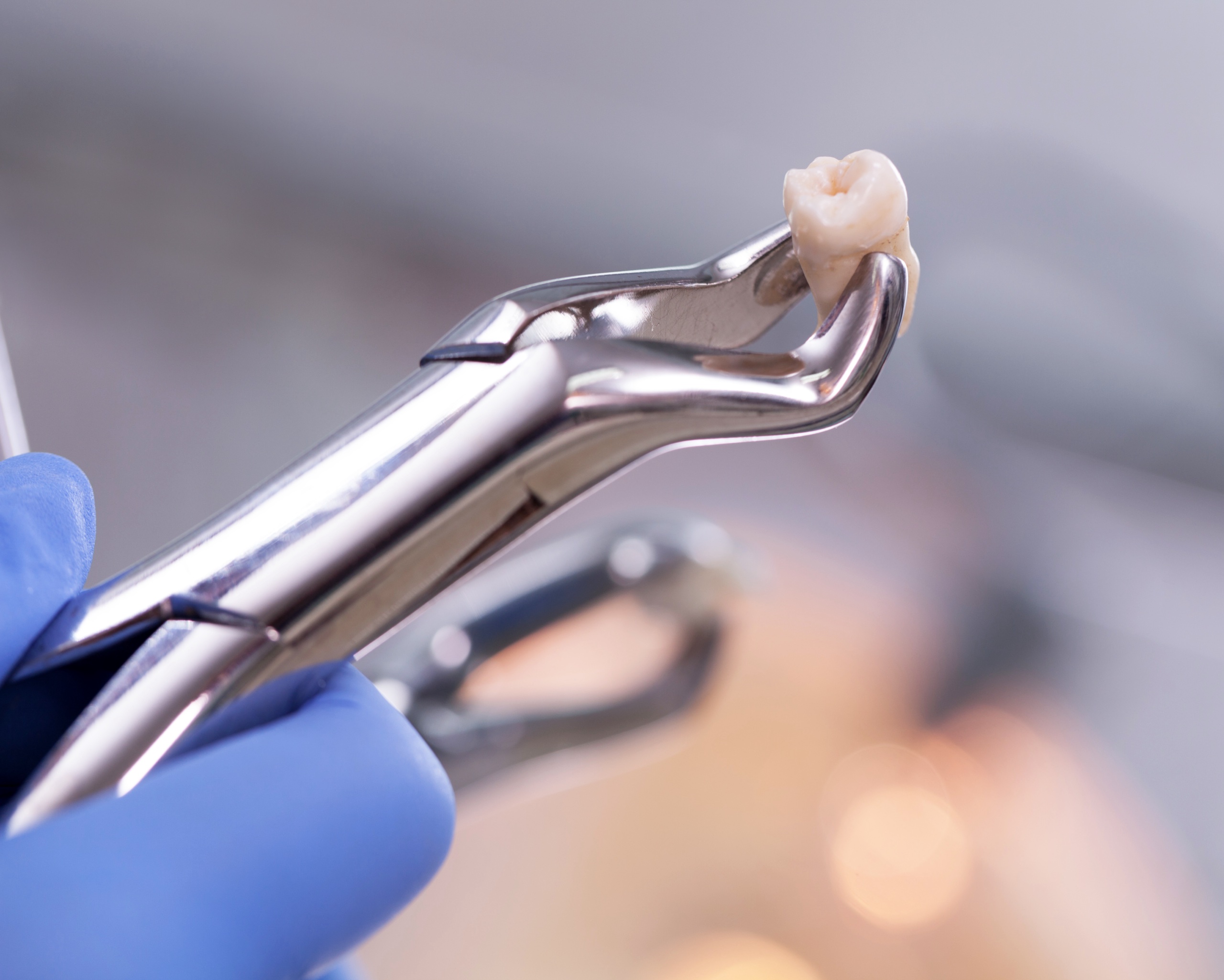 Dental equipment holding an extracted tooth